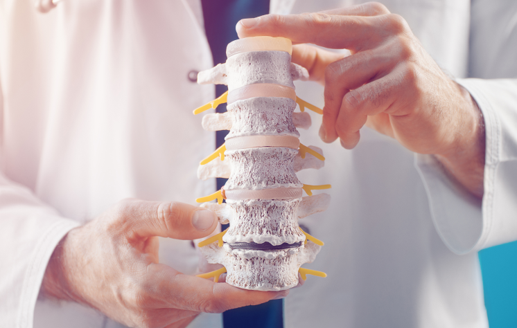 Imagem Osteoporose